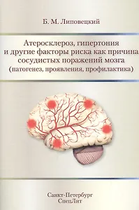 Атеросклероз,гипертония и другие факторы риска как причина с