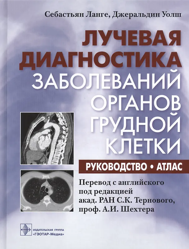 Книга Лучевая диагностика заболеваний органов грудной клетки : руководство : атлас () — 1