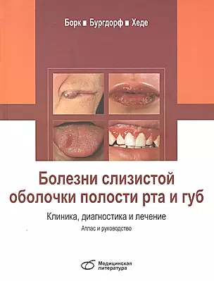 Болезни слизистой оболочки полости рта и губ. Клиника, диагностика и лечение. Атлас и руководство — 2809024 — 1