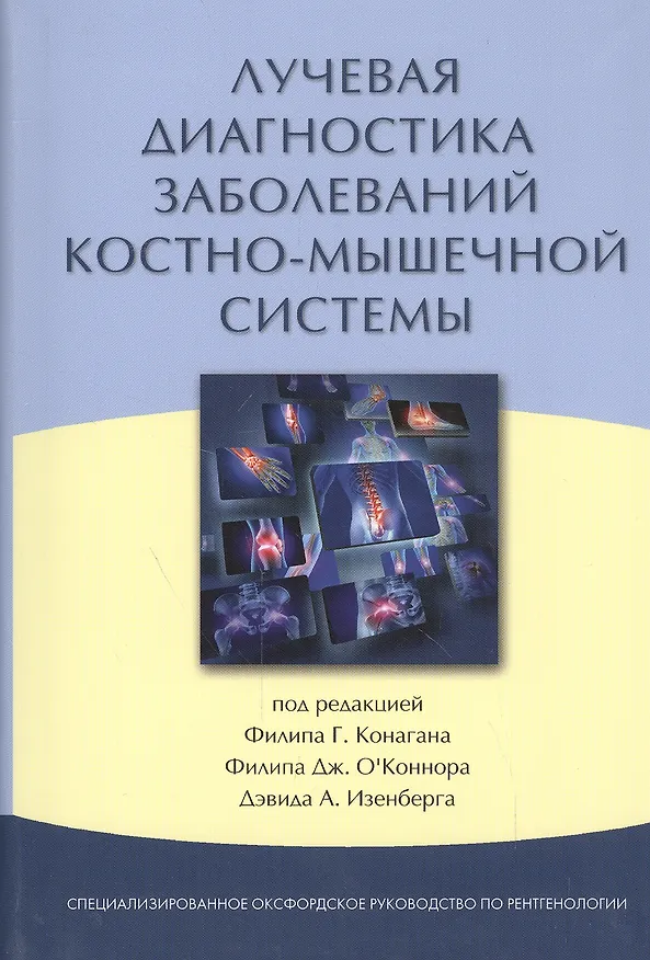 Книга Лучевая диагностика заболеваний костно-мышечной системы (Филип Конаган) — 1