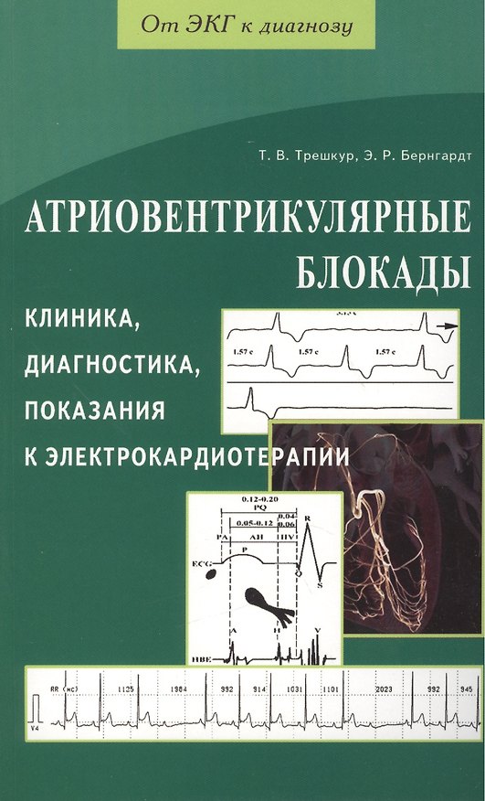 Книга Атриовентрикулярные блокады. Клиника, диагностика, показания к электрокардиотерапии () — 1