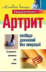 Артрит. Свобода движений без операций