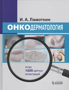 Онкодерматология: атлас: учебное пособие