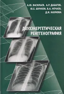 Двухэнергетическая рентгенография