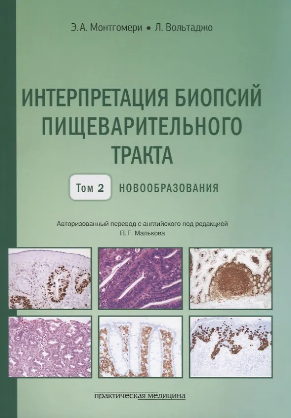 Книга Интерпретация биопсий пищеварительного тракта. Том 2. Новообразования (Лизандра Вольтаджо, Элисабет А. Монтгомери) — 1