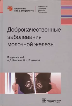 Доброкачественные заболевания молочной железы — 2621930 — 1