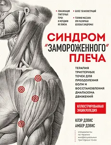 Синдром "замороженного" плеча. Терапия триггерных точек для преодоления боли и восстановления диапазона движений