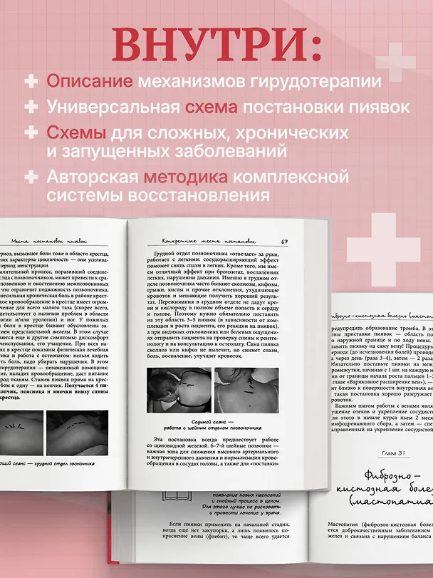 Книга Лечение пиявками. Схемы гирудотерапии при сложных, хронических и запущенных заболеваниях (Любовь Костикова) — 7