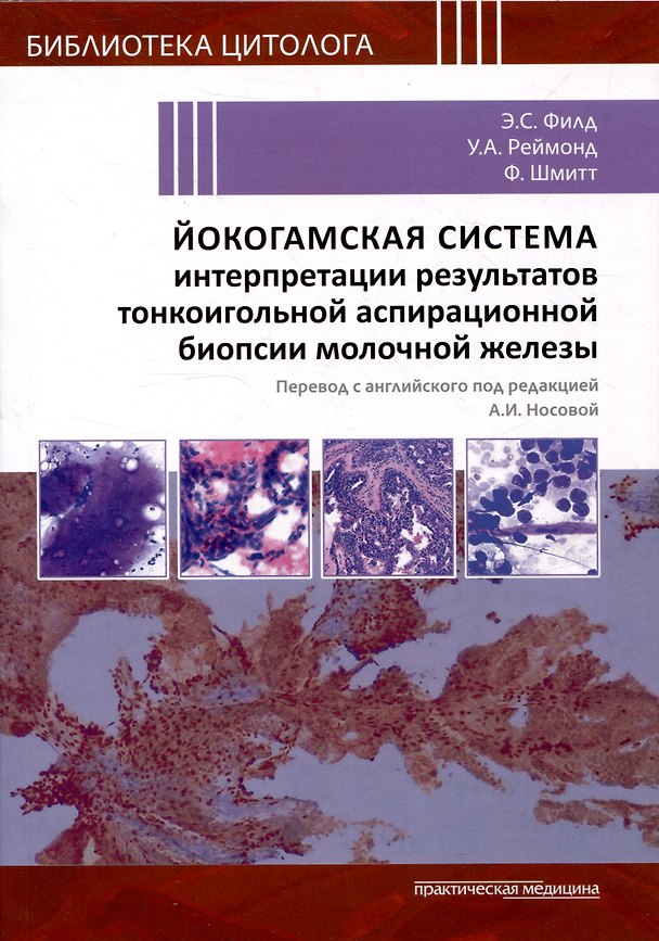 Книга Йокогамская система интерпретации результатов тонкоигольной аспирационной биопсии молочной железы (Ф. Шмитт, У.А. Реймонд, Э.С. Филд) — 1