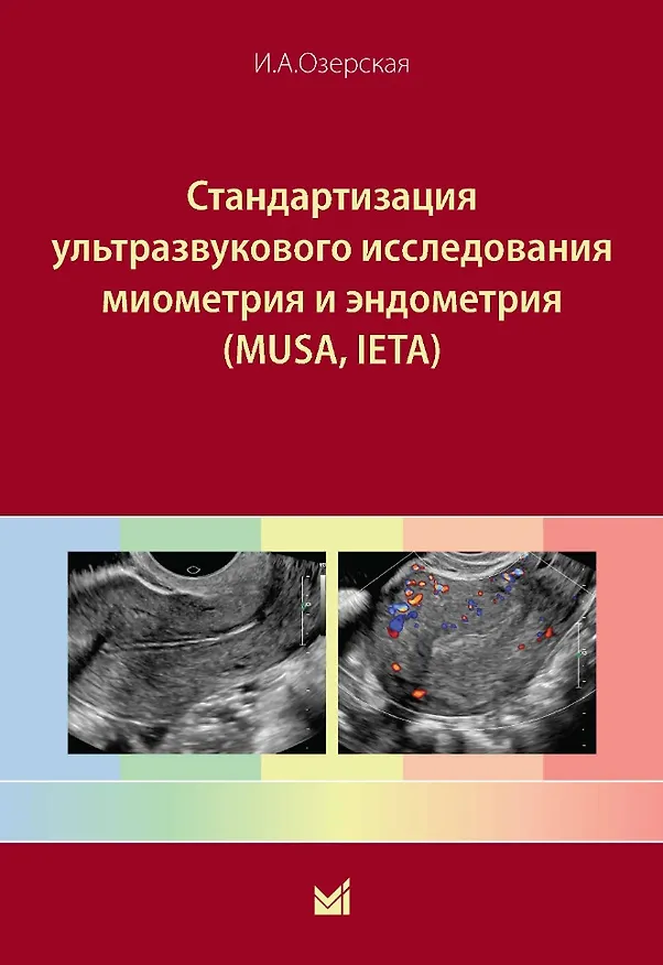 Книга Стандартизация ультразвукового исследования миометрия и эндометрия (MUSA, IETA) (Ирина Озерская) — 1
