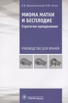 Миома матки и бесплодие. Стратегии преодоления. Руководство для врачей — 2834923 — 1