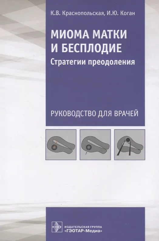 Книга Миома матки и бесплодие. Стратегии преодоления. Руководство для врачей (Ксения Краснопольская) — 1