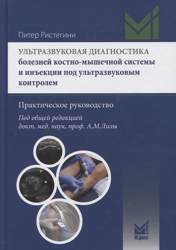 Книга Ультразвуковая диагностика болезней костно-мышечной системы и инъекции под ультразвуковым контролем. Практическое руковолство (Питер Ристегини) — 1