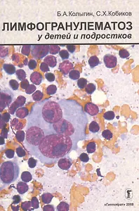 Лимфогранулематоз (лимфома Ходжкина) у детей и подростков