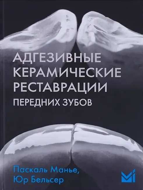 Книга Адгезивные керамические реставрации передних зубов (Юр Бельсер, Паскаль Манье) — 1
