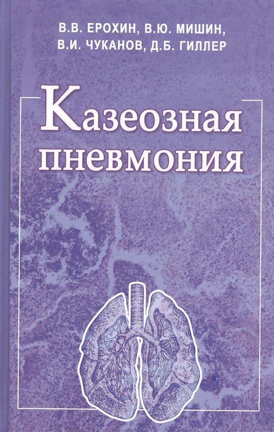 Книга Казеозная пневмония. Руководство для врачей () — 1