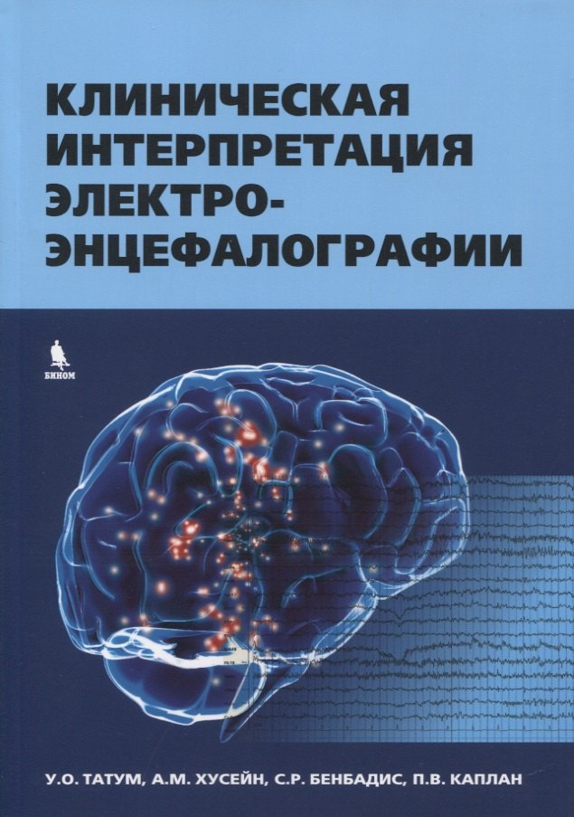 

Клиническая интерпретация электроэнцефалографии