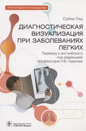 Диагностическая визуализация при заболеваниях легких: практическое руководство — 2958569 — 1