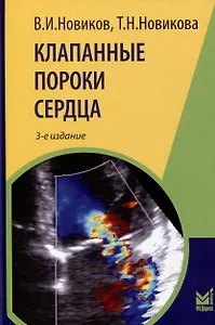 Клапанные пороки сердца