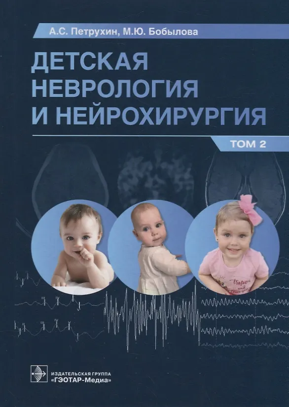 Книга Детская неврология и нейрохирургия: учебник: в 2-х томах. Том 2 (Андрей Петрухин, Мария Бобылова) — 1