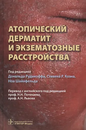 Книга Атопический дерматит и экзематорные расстройства ()