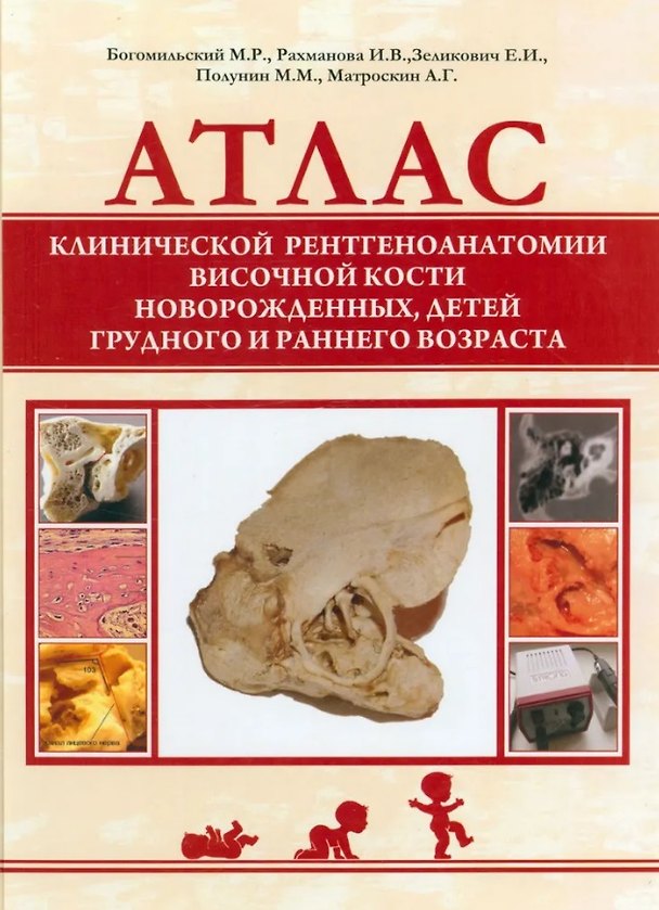 Книга Атлас клинической рентгеноанатомии височной кости новорожденных, детей грудного и раннего возраста (Михаил Богомильский, И. Рахманова, Е. Зеликович) — 1