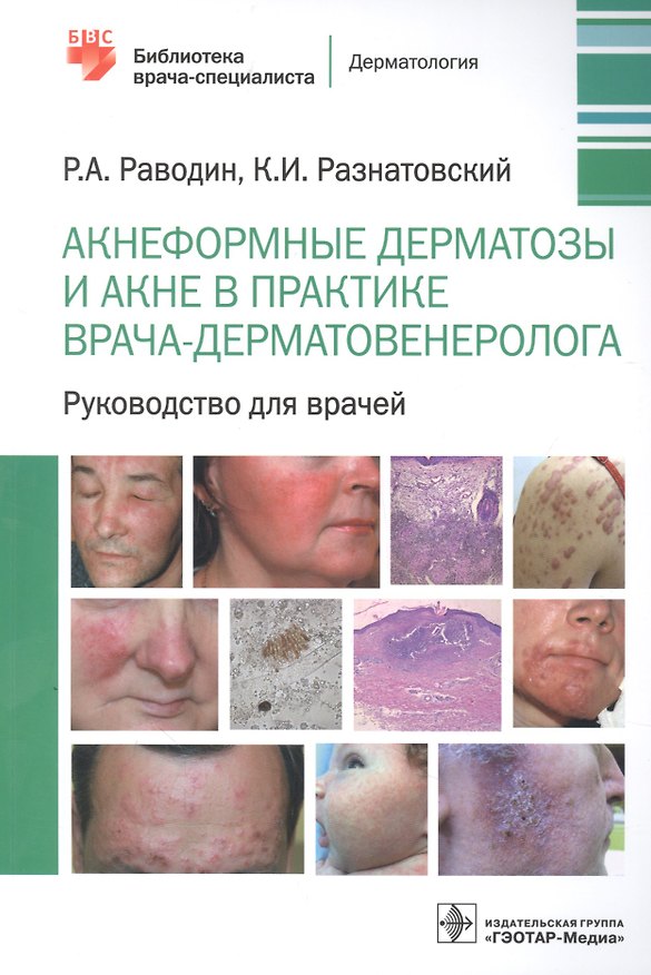 Книга Акнеформные дерматозы и акне в практике врача-дерматовенеролога: руководство для врачей (Роман Раводин, Константин Разнатовский) — 1