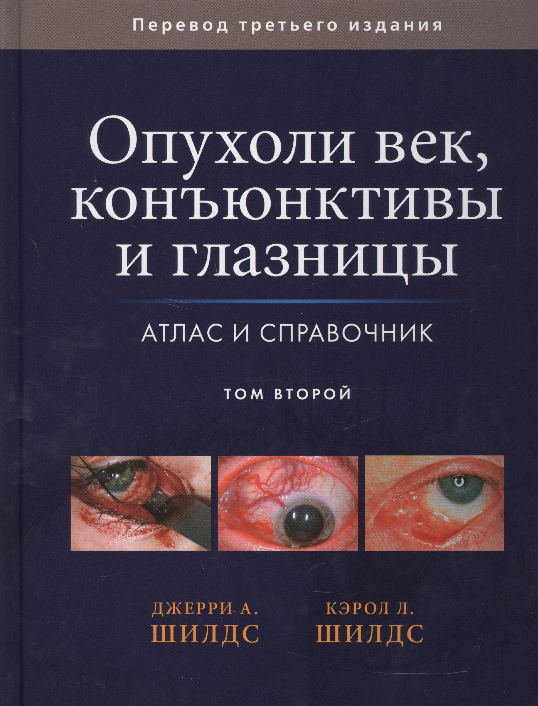 

Опухоли век, конъюктивы и глазницы. Атлас и справочник т.2