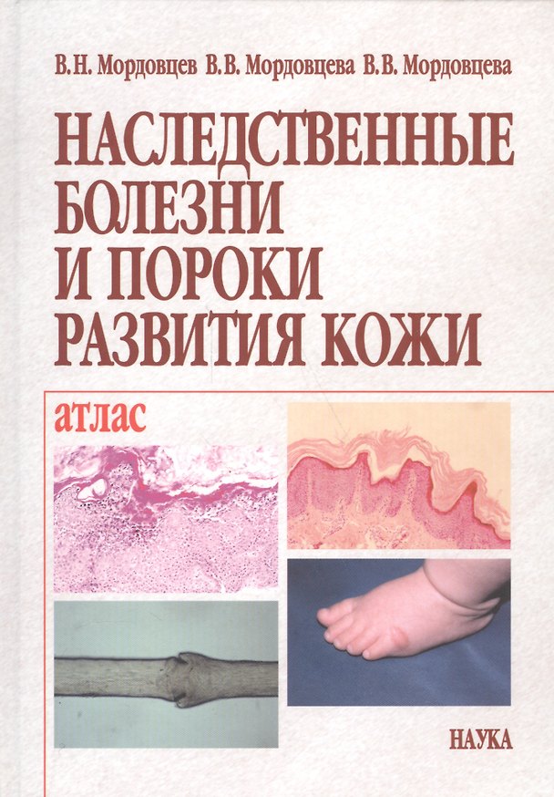 Книга Наследственные болезни и пороки развития кожи. Клиника. Морфология. Лечение. Атлас () — 1