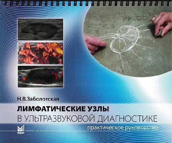 Книга Лимфатические узлы в ультразвуковой диагностике (Наталия Заболотская) — 1