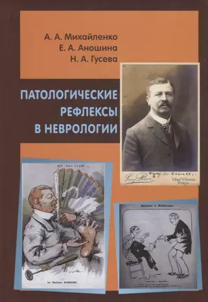 Патологические рефлексы в неврологии — 2647740 — 1