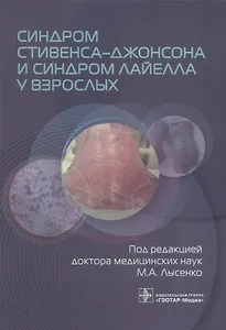 Синдром Стивенса–Джонсона и синдром Лайелла у взрослых
