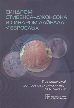 Синдром Стивенса–Джонсона и синдром Лайелла у взрослых — 2967127 — 1