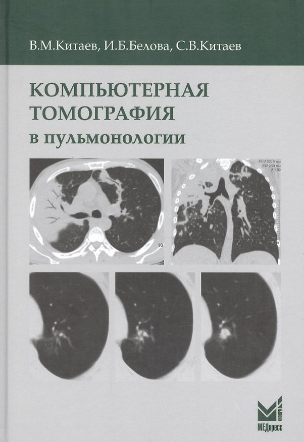 Книга Компьютерная томография в пульмонологии (Вячеслав Китаев, Сергей Китаев, Ирина Белова) — 1