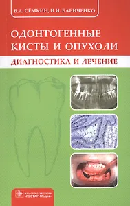 Одонтогенные кисты и опухоли. Диагностика и лечение