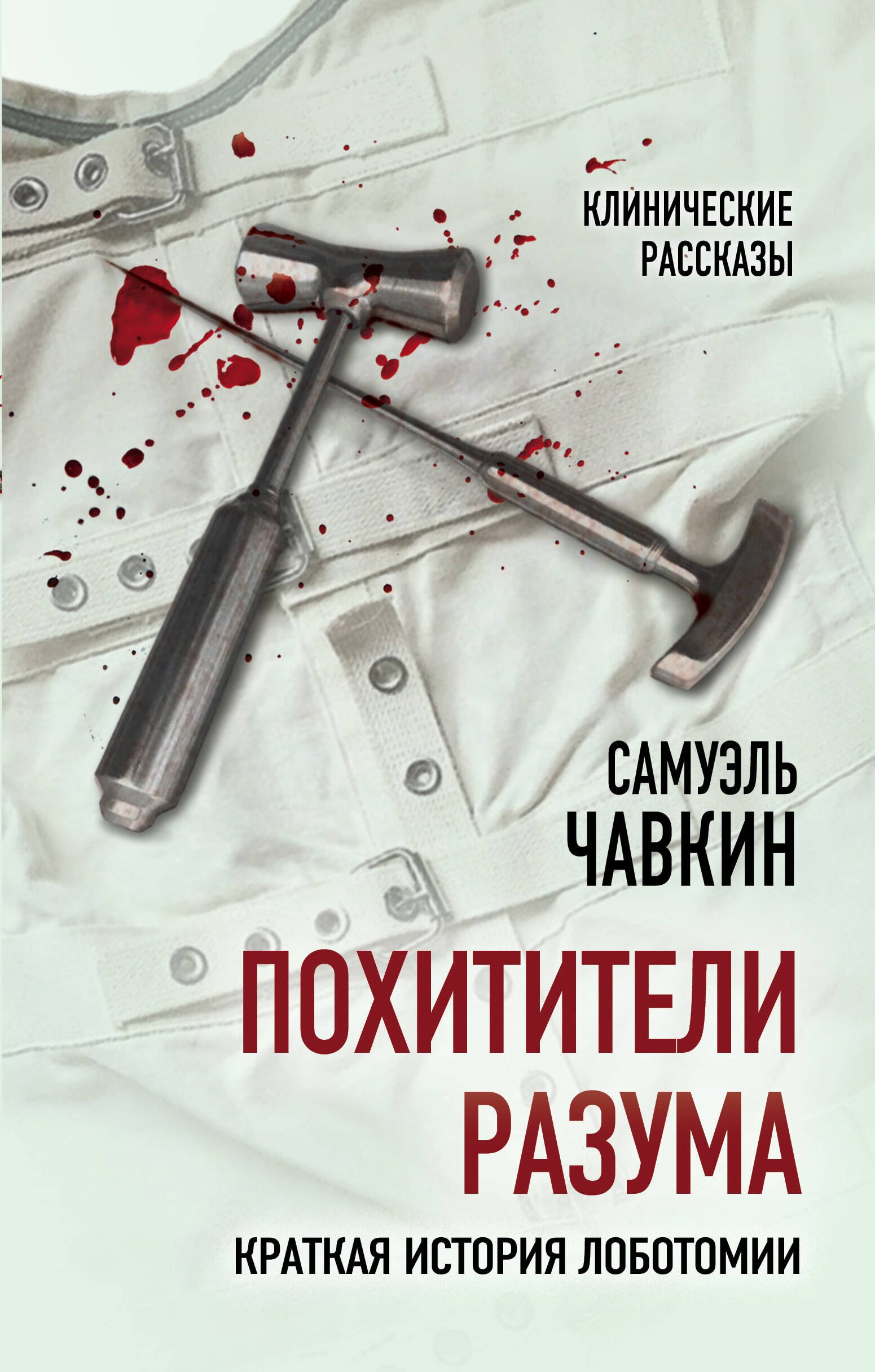 

Похитители разума. Краткая история лоботомии