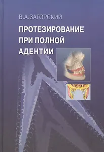 Протезирование при полной адентии.