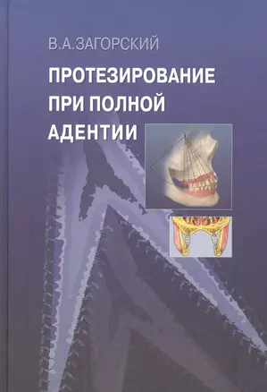 Протезирование при полной адентии. — 2791510 — 1