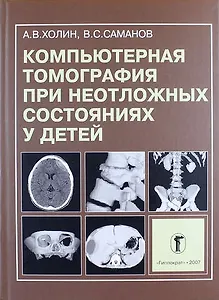Компьютерная томография при неотложных состояниях у детей