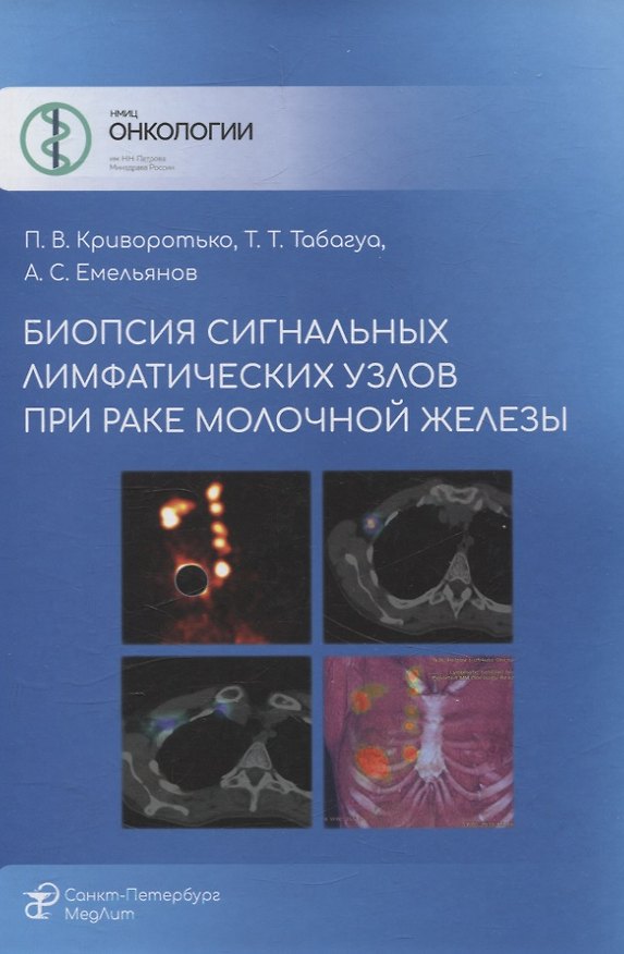 Книга Биопсия сигнальных лимфатических узлов при раке молочной железы (Александр Емельянов, Тенгиз Табагуа, Петр Криворотько) — 1