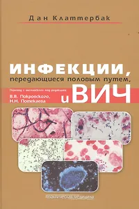 Инфекции, передающиеся половым путем, и ВИЧ-инфекция