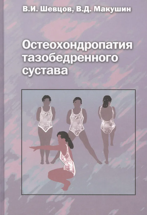 Книга Остеохондропатия тазобедренного сустава. Руководство для врачей (Георгий Шевцов) — 1