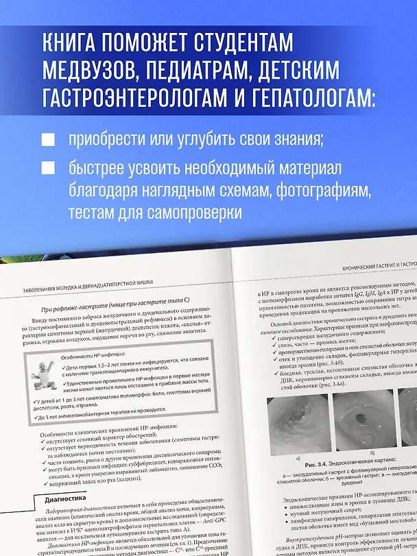 Книга Наглядная детская гастроэнтерология и гепатология. Учебное пособие (Рита Кильдиярова, Юрий Лобанов) — 7