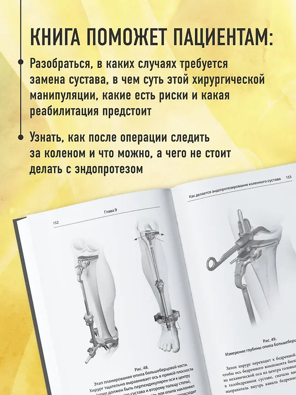 Книга Эндопротезирование коленного сустава: ответы практикующего врача на все вопросы пациентов (Андрей Середа) — 7