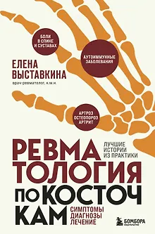 Ревматология по косточкам. Симптомы, диагнозы, лечение