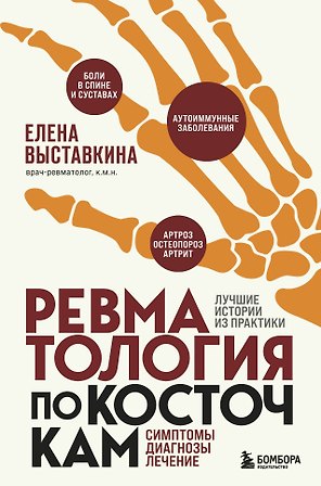 Ревматология по косточкам. Симптомы, диагнозы, лечение