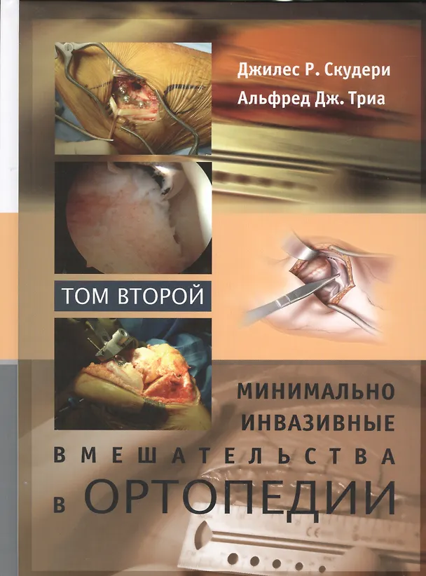 Книга Минимально инвазивные вмешательства в ортопедии: в 2-х томах. Том 2 () — 1