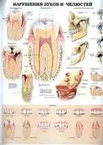 Плакат (70х108) Височно-нижнечелюстной сустав (ВНС) / Нарушения зубов и челюстей (А) — 2142438 — 1