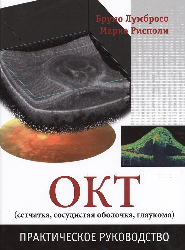 Книга ОКТ (сетчатка, сосудистая оболочка, глаукома). Практическое руководство () — 1