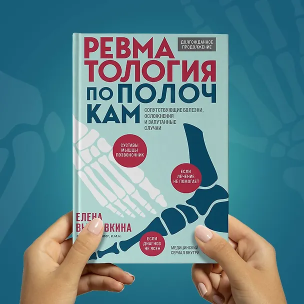 Книга Ревматология по полочкам. Сопутствующие болезни, осложнения и запутанные случаи (Елена Выставкина) — 9